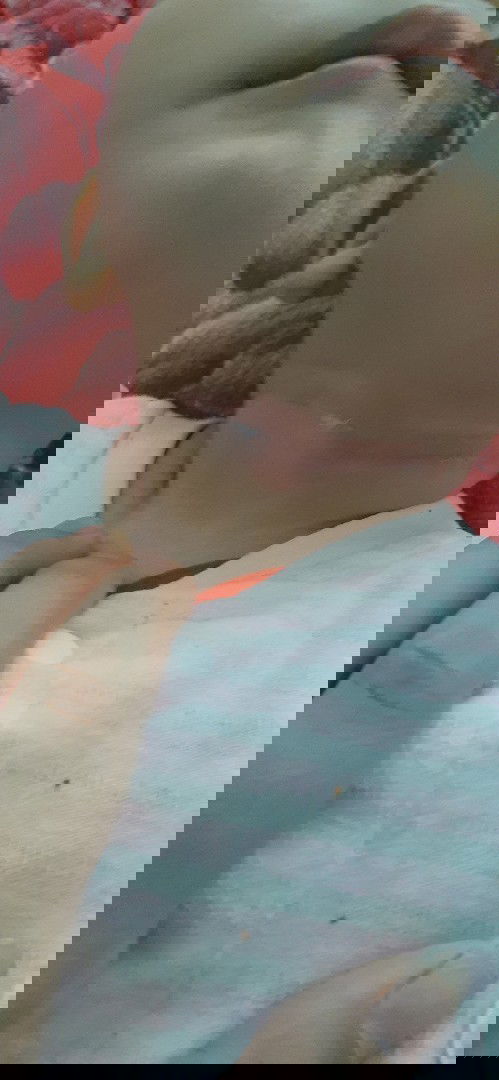 cổ  của  em bé  bị  đỏ  1 đường  ngang là  bị  gì  có  phải  do  hâm  khog m.n