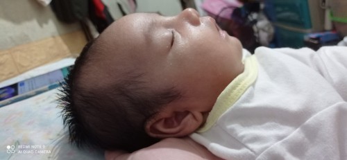 normal po ba shape ng ulo ng baby ko? mag one month plang sya bukas