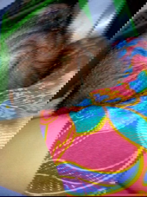 Bruntusan, dan ruam waktu bayi