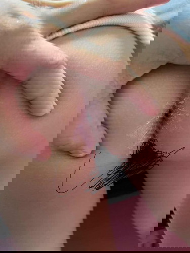 Diaper rash