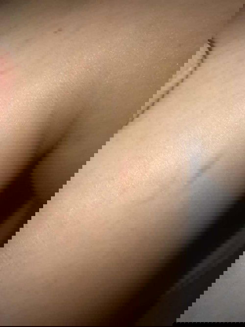 ของใครเป็นแบบนี้บ้างคะ