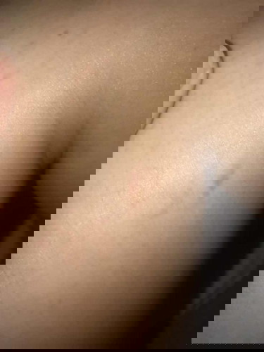 ของใครเป็นแบบนี้บ้างคะ