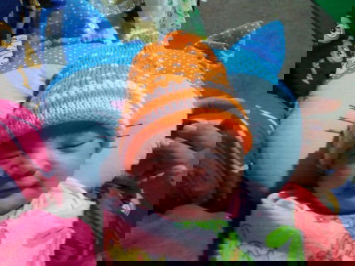 Habis oprasi Caesar  kena batuk2