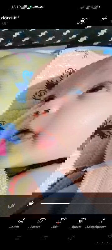 Ujung Lidah bayi seperti terbelah