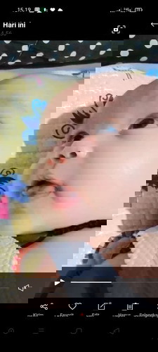 Ujung Lidah bayi seperti terbelah