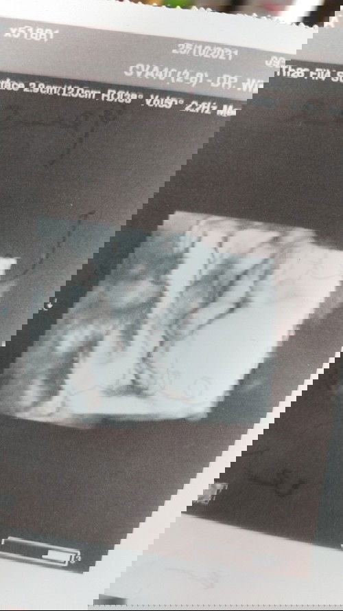 Baby twins❤️❤️