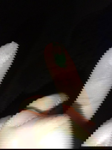 32+3w ท้องแรก