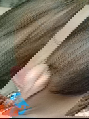 Namumula at namamaga