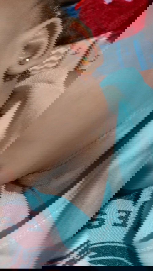 Hello mga mamsh question lang po ano po kaya itong nagappear sa leeg at braso ng baby ko?