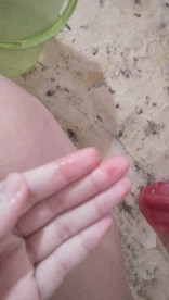 ต้องหาหมออีกรอบไหม มีเลือดอีกแล้ว เมื่อวานไปวิ่งงานหาเงินมา