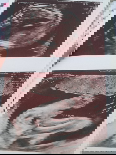 ทีม ก.พ.65 ได้ ญ รึ ช ครับโชว์หน่อย