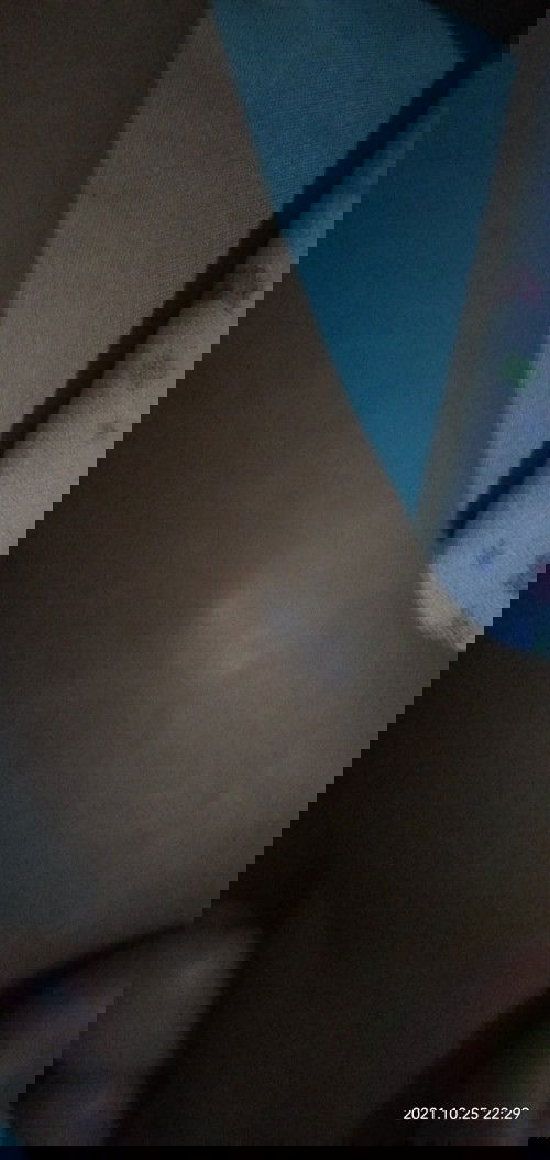 Bunda apakah bahaya jika terdapat benjolan seperti ini ?