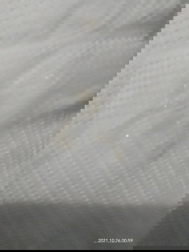 Em 39w 5d ra vậy kèm đau bụng có phải sắp sanh không ạ