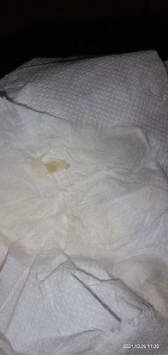 White discharge