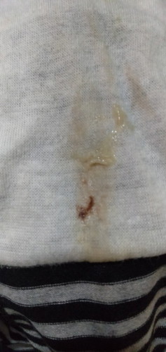 Mucus plug na po ba ito?