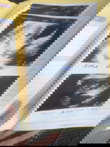 หน้าท้องหน้า/ลูกดิ้นกี่เดือน!?