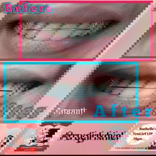 Whitening toothpaste