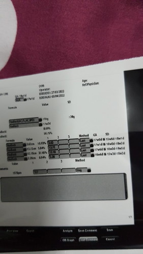 Ukuran bayi kecil seminggu dari Gestational Age