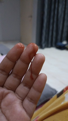 ni darah implantasi ke