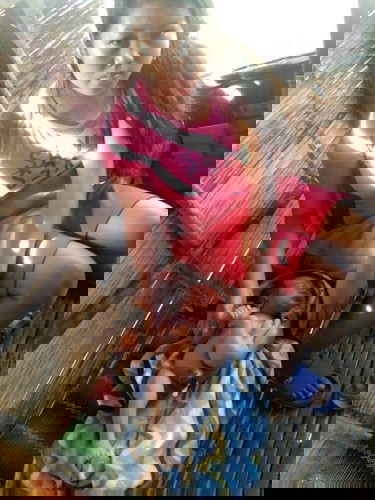 PISO PARA SA OPERASYON NG PAMANGKIN KO