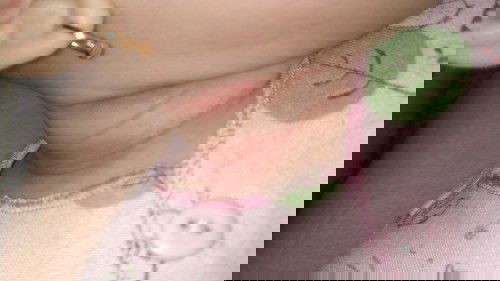 Bayi sy umur 3 bln ruam leher