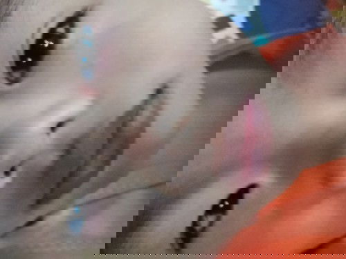 ลูก​ขยี้ตาบ่อยมาก