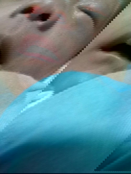 ผดผื่นเด็กทารกเกิดจากอะไร ??????