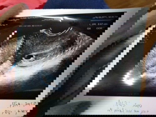 Perkembangan baby xseiring dengan minggu sepatutnya