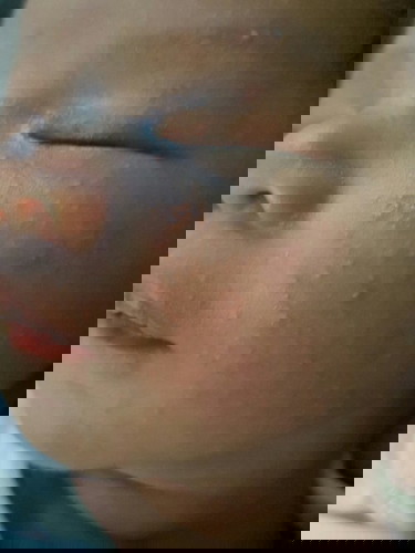 Ano pong gamot sa rashes sa mukha ni baby meron sa leeg mag 1 mnth po si baby ko mga mamshi...