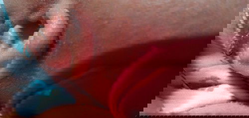 Ruam bgian blkg telinga