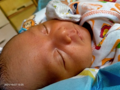 ขึ้นแบบนี้ใช้อะไรทาหายบ้างคะ