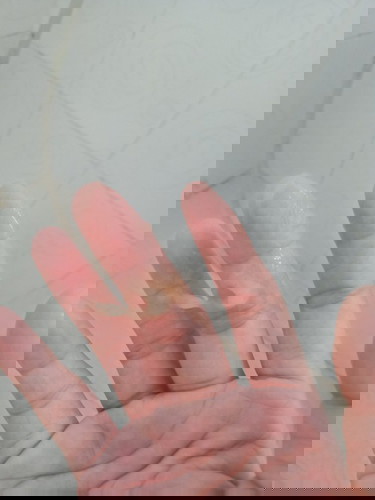 มีมูกแบบนี้มา 2วันแล้วคะ วันแรกเป็นสีน้ำตาลปนคะ วันที่2 เป็นแบบตามภาพเลยคะ วันนี้ก็มีแบบนี้อีกคะ