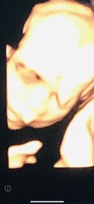 Post reply image