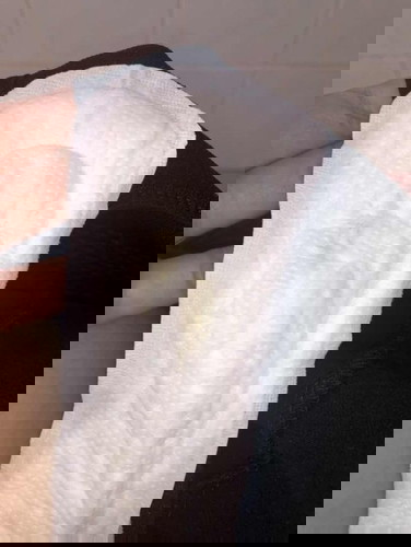 Vagina discharge early pregnancy