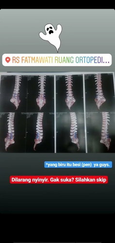 Menentukan proses lahiran
