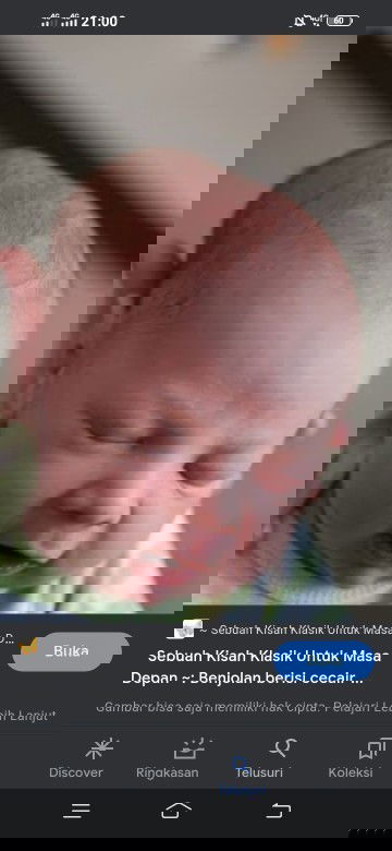 Kepala bayi benjol sebelah kiri dan lembek kaya difoto