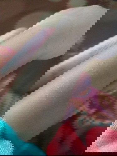 Bruntusan di kulit bayi