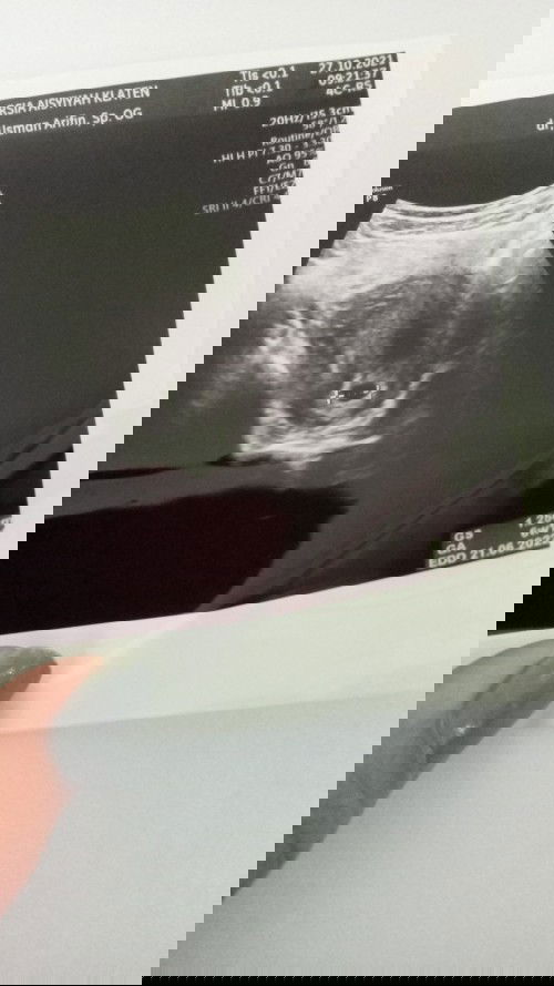 Seputar kehamilan 6 minggu