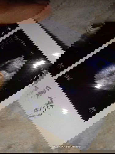 Hpl bidan dan usg berbeda.