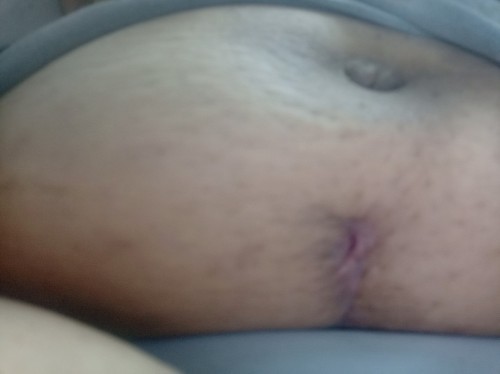 CS tahi nainfect