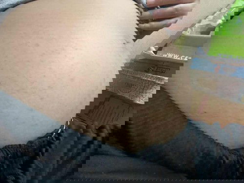 จุดผื่นแดงๆที่ท้อง