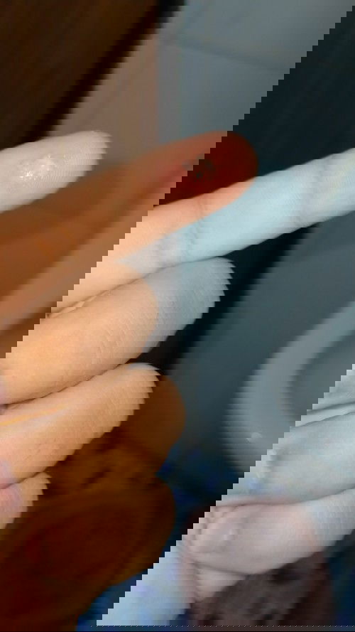 แม่ๆคะ แบบนี้คืออะไรคะ เหนียวๆยืดๆ ไม่ปวดท้องไม่มีน้ำเดิน 39+5