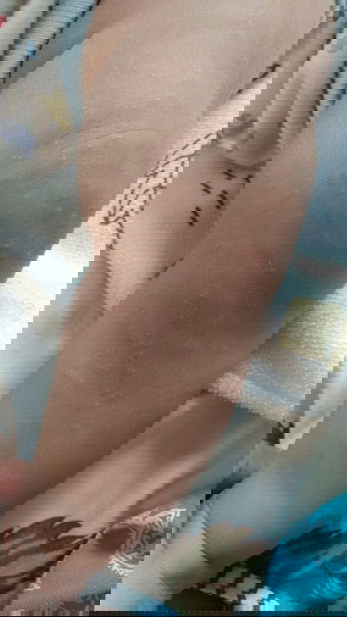 Bruntusan sebadan badan