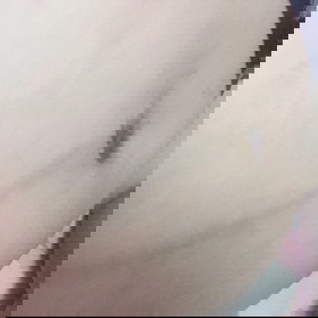 สะดือบานไม่คว่ำไม่หงาย