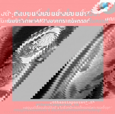 ภาพสแกน MRI ของเจ้าตัวเล็กในท้อง แม่เคยเห็นไหม