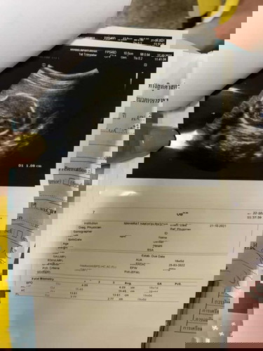 พบถุงน้ำในสมองลูก มีโอกาสหายไหม😢