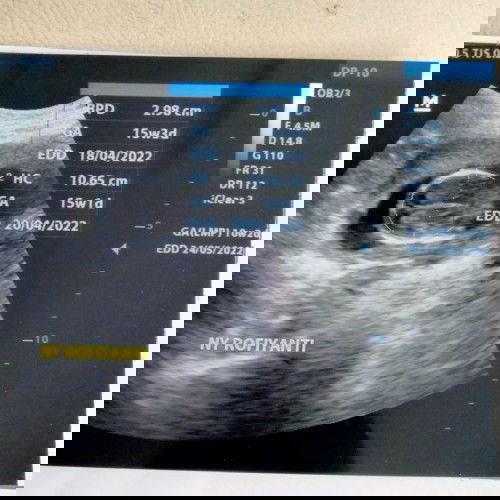 Hasil USG dan usia kandungan