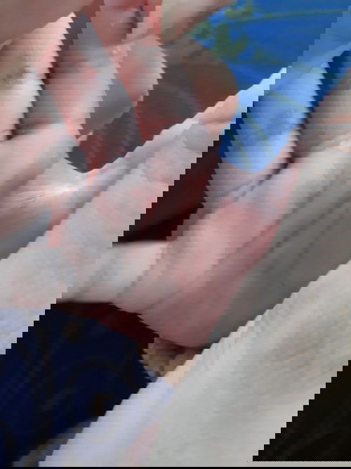 Bé bị như này có phải triệu chứng tay chân miệng k mn