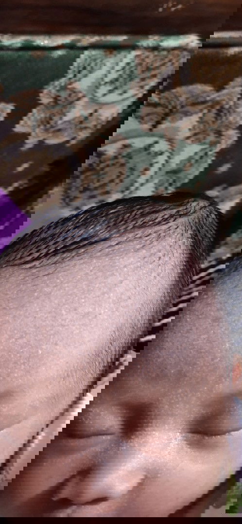 Benjolan empuk dikepala