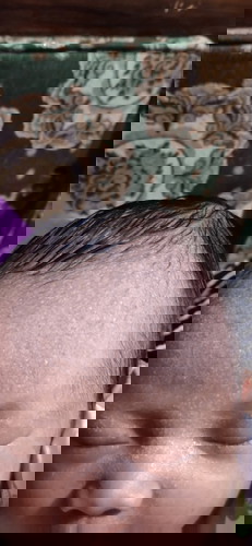 Benjolan empuk dikepala